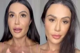 “Reaprendendo a andar”, diz Gracyanne Barbosa sobre cirurgia no joelho