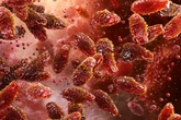 Botulismo: é possível identificar alimentos contaminados?