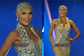 Vídeo: modelo com alopecia tira a peruca durante concurso de beleza