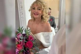 Mulher tem paralisia no rosto após lua de mel ser cancelada na véspera