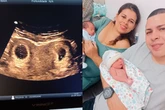 Com 2 úteros, mãe diz que gêmeos “tinham quarto separado na barriga”