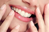 Clareamento dental com caneta funciona? Especialista responde