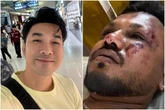 Cantor sobreviveu a queda de avião sentado na mesma poltrona de indiano