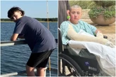 Menino tem 11% do corpo queimado após vídeo viral no TikTok dar errado