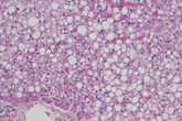 Cérebro flex: estudo descobre que gordura é combustível dos neurônios