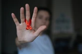 Brasil tem queda da transmissão vertical do HIV, de mãe para filho