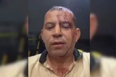 Vídeo. Motorista de ônibus fica ferido após reagir a assalto no Rio