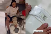 Gracyanne choca os fãs ao mostrar quantos quilos ganhou com internação