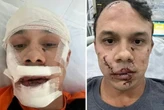 Saiba o que disse na DP playboy que espancou personal em briga de bar