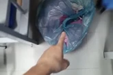 Roupas no chão do HBDF: gestora priorizou bem-estar coletivo, diz Iges-DF
