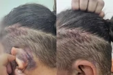 Punição por engano: trio que sequestrou e torturou mulher é preso