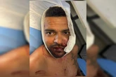 “Achei que ia morrer”, diz jovem que teve rosto rasgado por advogado