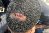 PM atira em homem sentado na calçada durante apreensão de motos. Veja