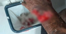 Atacado com facão, homem quase perdeu a mão em Campo Grande