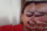Homem agride mulher a socos no DF, foge para Goiás, mas acaba preso