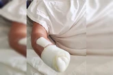 “Violência feroz”: homem arranca mão da esposa usando foice e facão