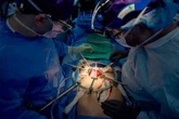 Cientistas descobrem como o corpo humano reage a xenotransplantes