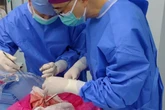 Primeiro transplante de pulmão de porco em humano funciona por 9 dias