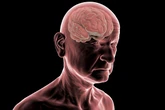 Estudo: demência pode levar mais de três anos para ser diagnosticada