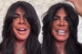 Gretchen anuncia novos procedimentos: “Rosto fininho”