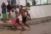 Vídeo: rapaz perde o dedo após espada pirotécnica explodir na mão dele