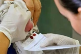 Teste do pezinho: estados não têm insumos para exame básico de bebês