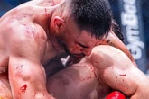 Cenas fortes: lutador de MMA desloca mandíbula após vitória