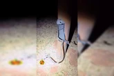 Quatro e contando: homem é preso mais uma vez por furto de cabos no DF