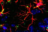 Cientistas identificam molécula que protege cérebro e reverte demência