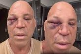 Empresário de Wanderlei Silva pede anulação da vitória de Popó