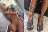 “Tão triste ser abandonado”, diz idosa resgatada de abrigo. Veja vídeo