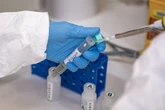 Butantan cria dois testes rápidos que detectam leptospirose em 25 min