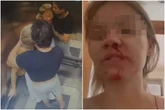 Vídeo: homem agride namorada, limpa sangue com camisa e depois a beija