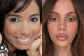 Anitta antes e depois: confira o quanto a cantora mudou desde 2013