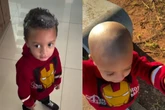 Vídeo: criança usa creme depilatório na cabeça e perde o cabelo