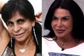Blefaroplastia: quando investir no procedimento realizado por Gretchen