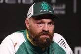 Lenda do boxe revela susto com jatinho após problemas na asa; veja