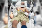 Homem quebra pescoço ao cair de cais em 50 cm de água: “Recuperando”