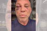 Wanderlei Silva detalha recuperação: “Memória está voltando”. Vídeo