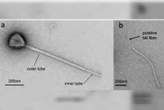 Cientistas encontram vírus com a cauda mais longa já observada