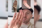 Vídeo: médico ensina truque com dedo que avalia risco de aneurisma