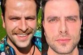 Trocou de rosto? Entenda a harmonização facial de Gustavo Marsengo