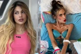 Morre influencer de 30 anos que pesava 22 kg: “Arruinaram a vida dela”