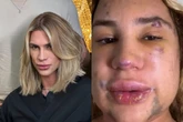 Influencer que morreu após procedimento havia denunciado médico