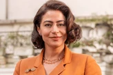Rosácea: entenda a condição relatada pela atriz Carol Castro