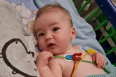 Bebê sofrer dano cerebral grave após ter contato com vírus comum