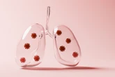 Entenda o que é pneumonia silenciosa, que tem alertado autoridades