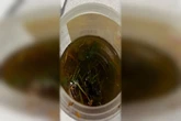 Bebê de 1 ano é intoxicado após ingerir mistura com álcool e maconha