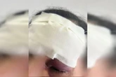 Homem ataca companheira com socos e arremessa celular no rosto dela