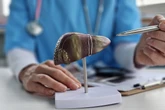 Hepatite D passa a ser considerada cancerígena pela OMS